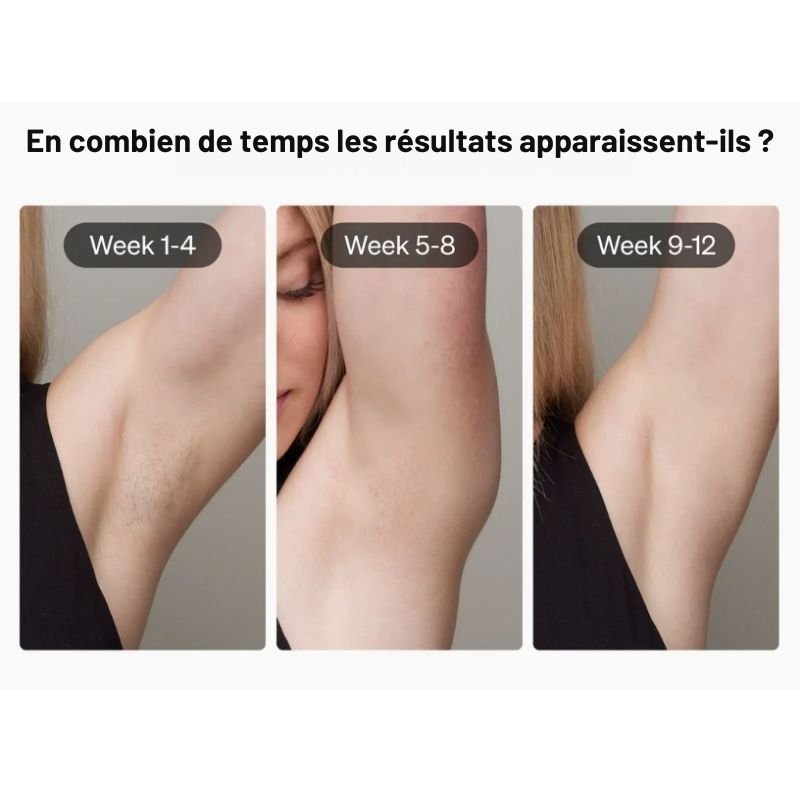 Épilateur Lumière Pulsée PreciosaLum™: Épilation Durable - PreciosaWoman™