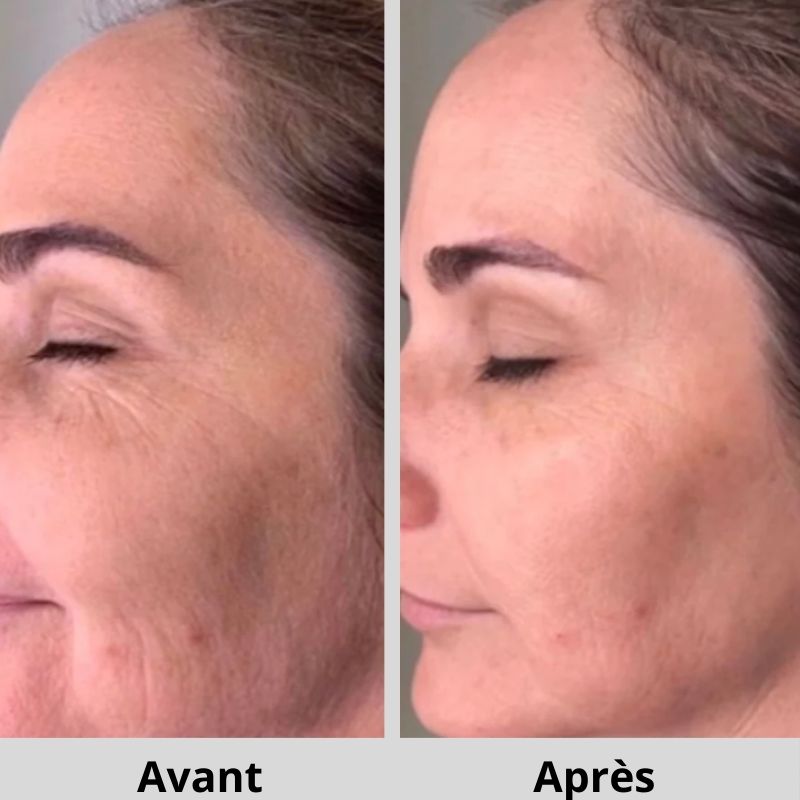 Masseur pour visage : l'appareil anti - rides Liftant PreciosaSkin lift™ - PreciosaWoman™